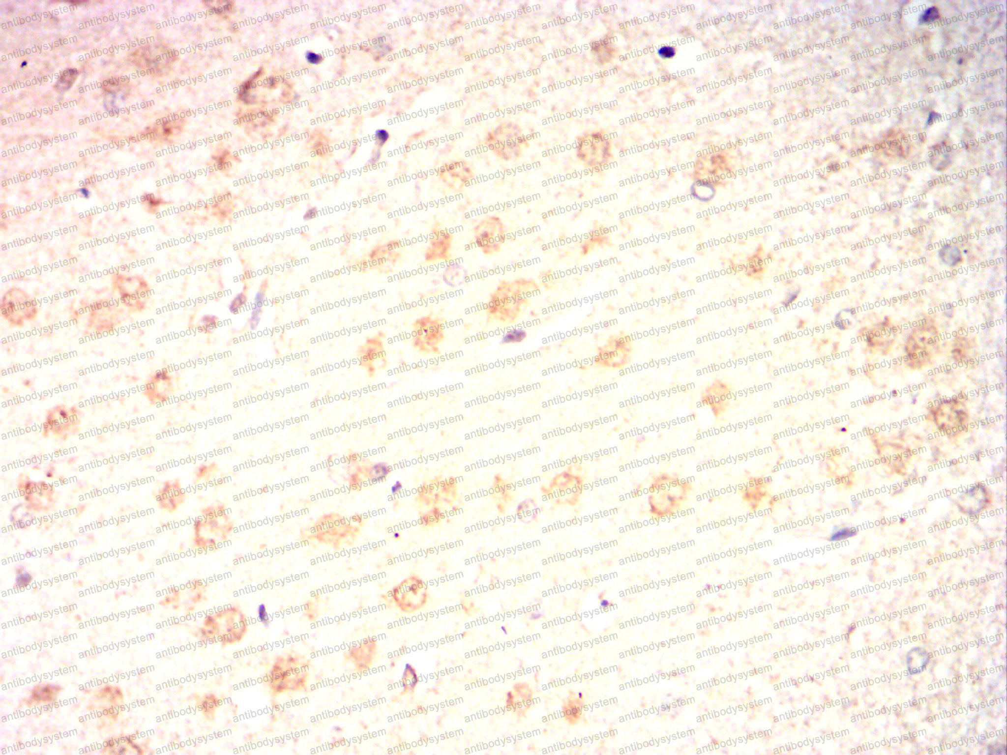 Валидация AntibodySystem RHG90002 (3112)
