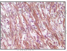 Валидация AntibodySystem RHD25502 (1427)