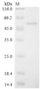 SDS-PAGE