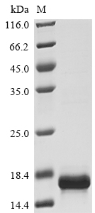 SDS-PAGE