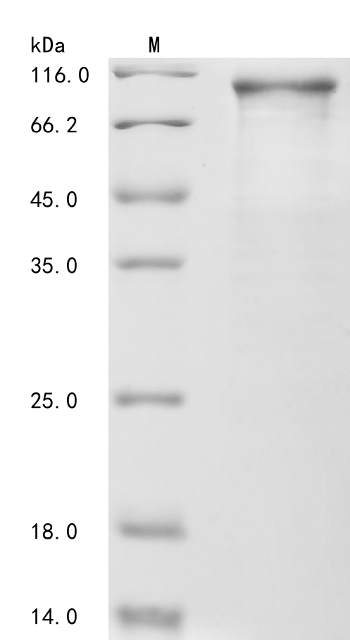 SDS-PAGE