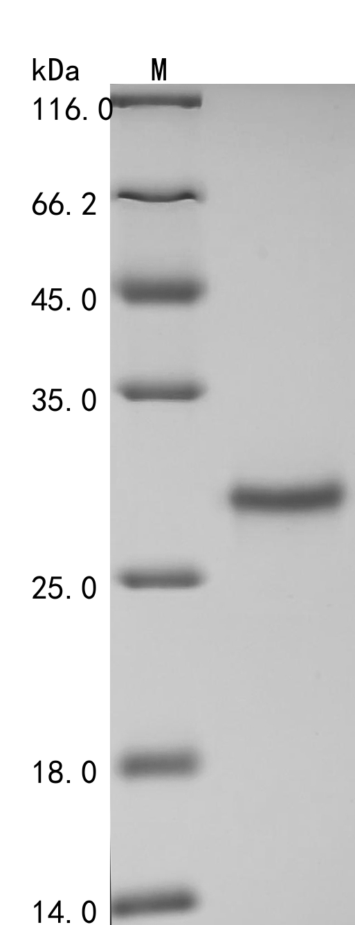 SDS-PAGE