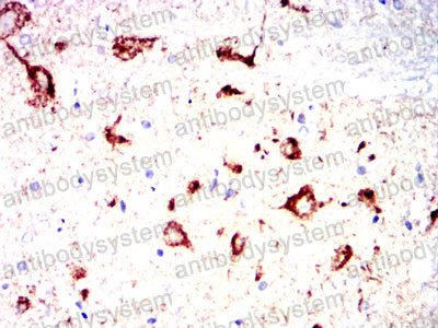 Валидация AntibodySystem RHG06501