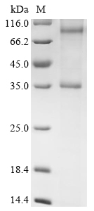 SDS-PAGE