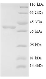 SDS-PAGE