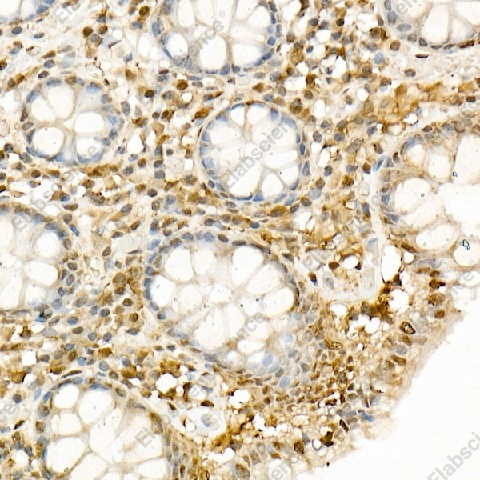 Иммуногистохимия, Hsp90β, ткань толстой кишки человека
