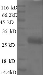 SDS-PAGE