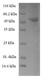 SDS-PAGE