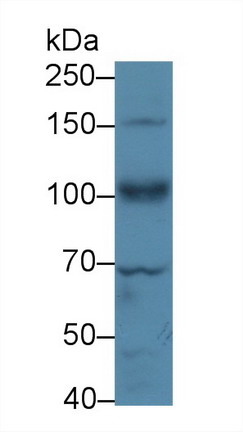 10148