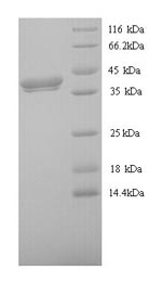 SDS-PAGE
