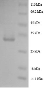 SDS-PAGE