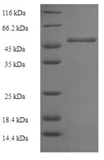 SDS-PAGE