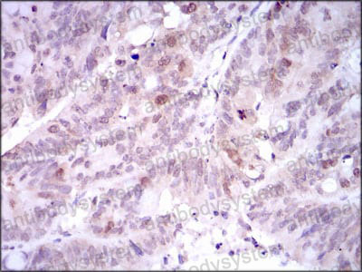 Валидация AntibodySystem RHE97404