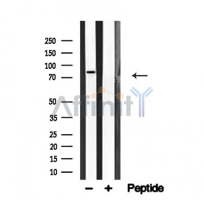 Валидация Affinity AF4626 - 2238