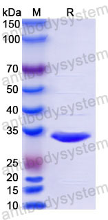 YHC36303, SDS-PAGE