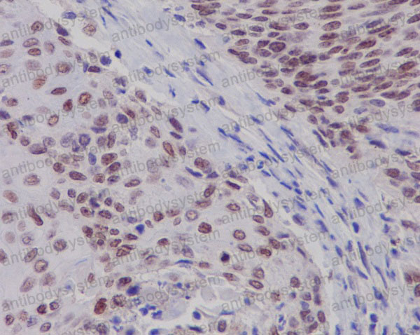 Валидация AntibodySystem RHJ32701