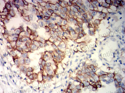 Валидация AntibodySystem RHC98504