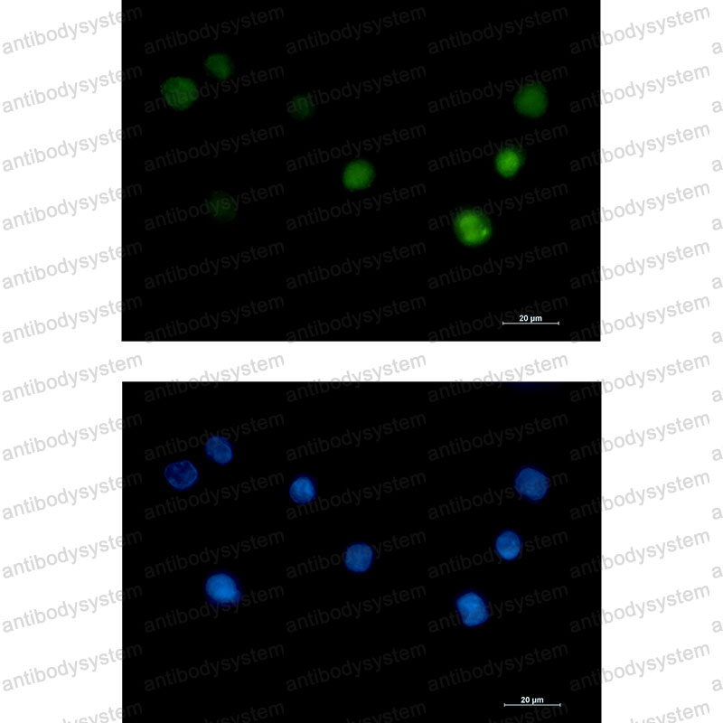 Валидация IF - AntibodySystem RHJ32401
