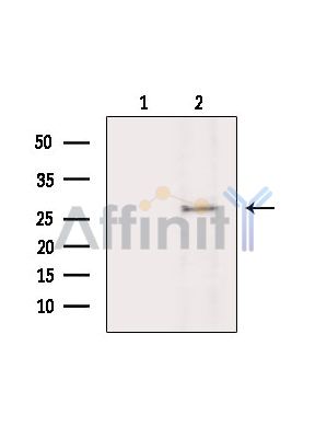 Валидация Affinity DF15640 - 12071