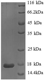 SDS-PAGE