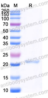 YHF19806, SDS-PAGE