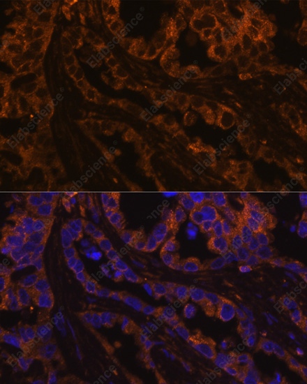 Иммунофлуоресценция, Cytokeratin 7, клетки рака легкого человека