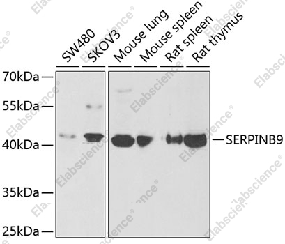 Вестерн-блоттинг, SERPINB9, различные клеточные линии