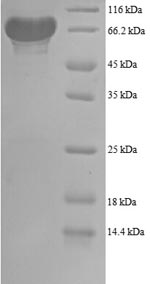 SDS-PAGE