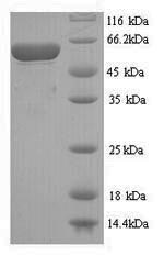 SDS-PAGE