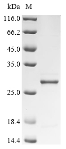 SDS-PAGE