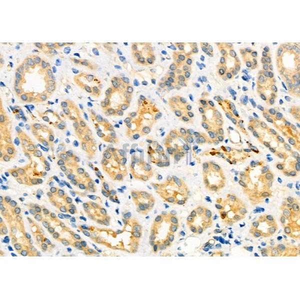 Валидация Affinity DF12445 - 6973