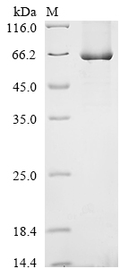 SDS-PAGE