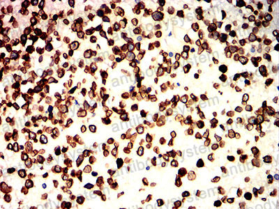 Валидация AntibodySystem RHD40902 (1573)