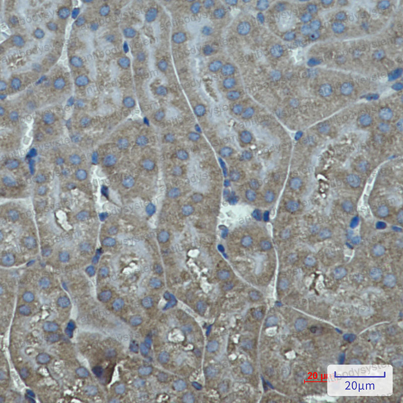 Валидация AntibodySystem RHC12901