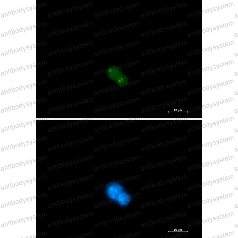 Валидация IF - AntibodySystem RHN38101