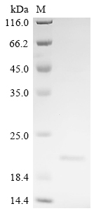 SDS-PAGE