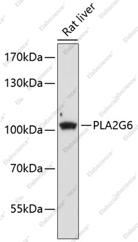 Вестерн-блоттинг, PLA2G6, ткань печени крысы