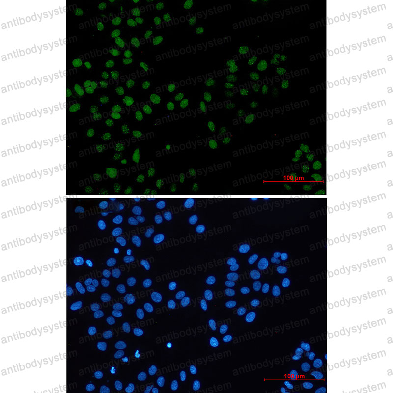 Валидация IF - AntibodySystem RHE07801