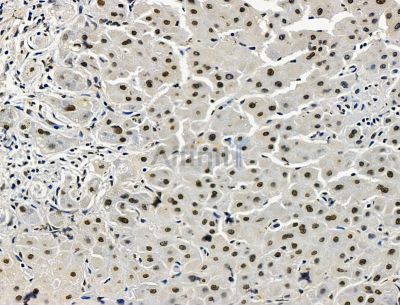 Валидация Affinity DF15314 - 11617