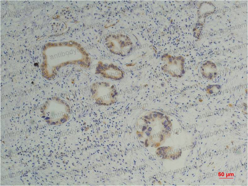 Валидация AntibodySystem RHD56504 (1649)
