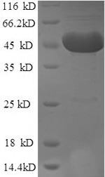 SDS-PAGE