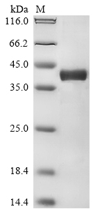 SDS-PAGE