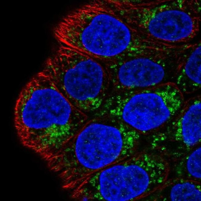 Валидация AssayVector ARM1876(2534)