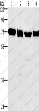 Вестерн-блоттинг, IL2RB, клетки 231, 293T, Raji и HeLa