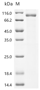 SDS-PAGE