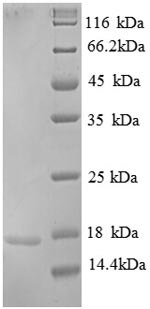 SDS-PAGE