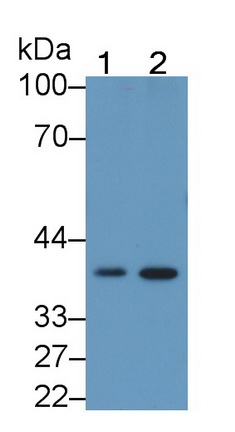 39315