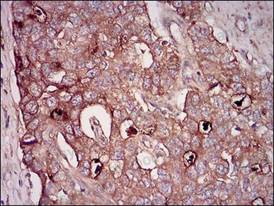 Валидация AntibodySystem RHD46603