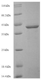 SDS-PAGE