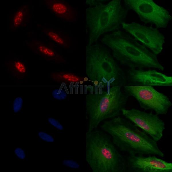 Валидация Affinity AF9265 - 5087
